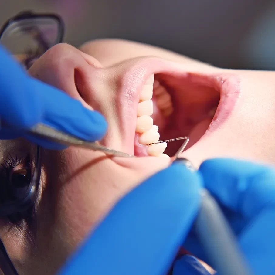 Bone Grafting