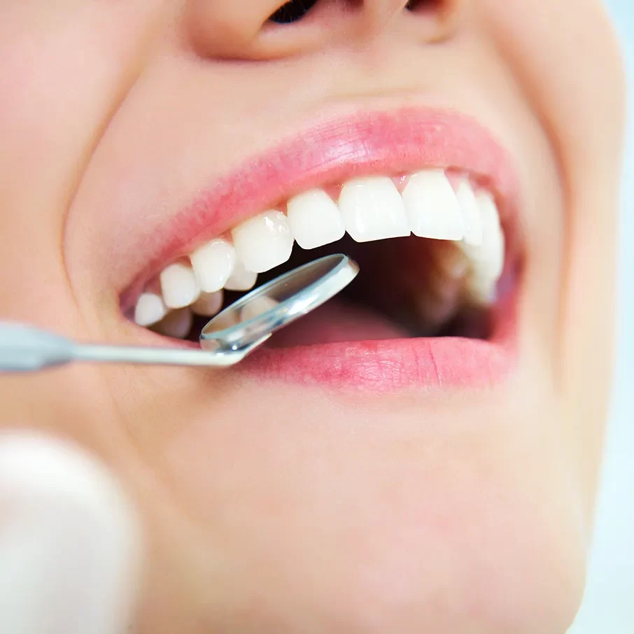Dental Bonding