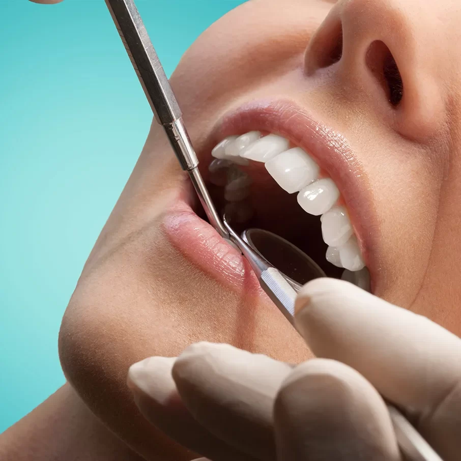 Dental Exams