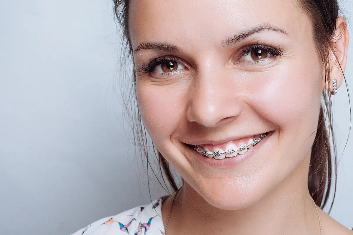 Orthodontic Treatment Offer