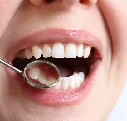 Restorative Dentistry